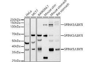 Western blot analysis of extracts of various cell lines, using SPINK5/LEKTI antibody (ABIN7270212) at 1:1000 dilution. (SPINK5 Antikörper)