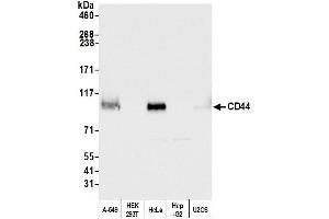 Western Blotting (WB) image for anti-CD44 (CD44) (AA 692-742) antibody (ABIN7453578) (CD44 Antikörper  (AA 692-742))