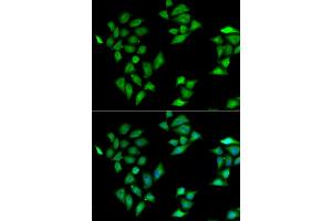 Immunofluorescence analysis of HeLa cells using ITLN1 antibody (ABIN5974359). (ITLN1/Omentin Antikörper)