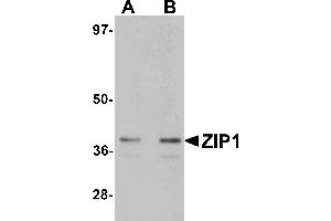 Western Blotting (WB) image for anti-Solute Carrier Family 39 (Zinc Transporter), Member 1 (SLC39A1) (N-Term) antibody (ABIN1031679) (SLC39A1 Antikörper  (N-Term))