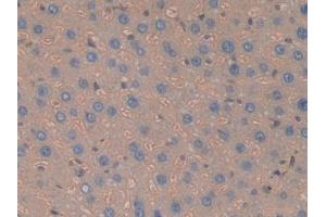 DAB staining on IHC-P; Samples: Rat Liver Tissue (Haptoglobin Antikörper  (AA 70-332))