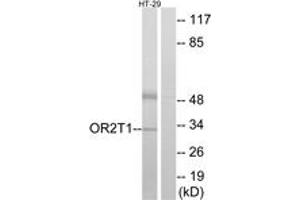 Western blot analysis of extracts from HT-29 cells, using OR2T1 Antibody. (OR2T1 Antikörper  (AA 231-280))