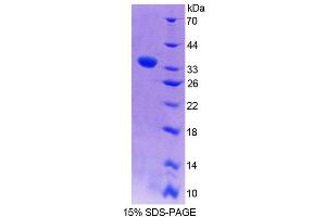 SDS-PAGE analysis of Rat WASP Protein.