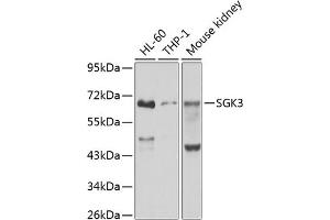 Western blot analysis of extracts of various cell lines, using SGK3 antibody (ABIN6132066, ABIN6147709, ABIN6147710 and ABIN6223495) at 1:1000 dilution. (SGK3 Antikörper  (AA 1-150))