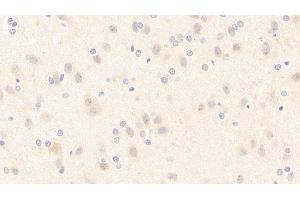 Detection of NOS1 in Rat Cerebrum Tissue using Polyclonal Antibody to Nitric Oxide Synthase 1, Neuronal (NOS1) (NOS1 Antikörper  (AA 9-136))