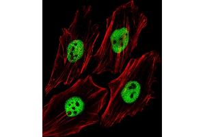 Fluorescent image of Hela cells stained with (Mouse) Trim24 Antibody (C-term) (ABIN6244019 and ABIN6577664). (TRIM24 Antikörper  (C-Term))