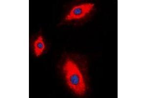Immunofluorescent analysis of Granzyme A staining in HepG2 cells.