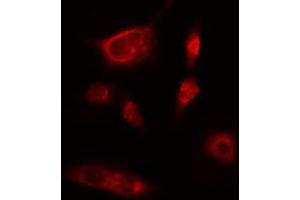 ABIN6274219 staining Hela cells by IF/ICC. (ITPKB Antikörper  (Internal Region))
