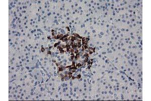 Immunohistochemical staining of paraffin-embedded Human pancreas tissue using anti-RGS5 mouse monoclonal antibody. (RGS5 Antikörper)