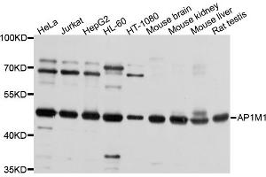 Western blot analysis of extracts of various cell lines, using AP1M1 antibody.
