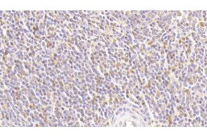 Detection of ATG16L1 in Human Spleen Tissue using Polyclonal Antibody to Autophagy Related Protein 16 Like Protein 1 (ATG16L1) (ATG16L1 Antikörper  (AA 1-284))
