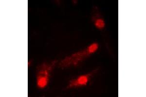 Immunofluorescent analysis of p53 (AcK386) staining in HeLa cells.