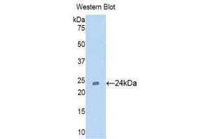 Western Blotting (WB) image for anti-Cell Division Cycle 25 Homolog B (S. Pombe) (CDC25B) (AA 377-566) antibody (ABIN1171796) (CDC25B Antikörper  (AA 377-566))