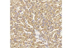 Immunohistochemistry (Paraffin-embedded Sections) (IHC (p)) image for anti-Heat Shock 60kDa Protein 1 (Chaperonin) (HSPD1) antibody (ABIN7074167)