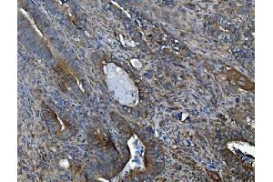 IHC analysis of ALK-1/ACVRL1 using anti-ALK-1/ACVRL1 antibody (ABIN7601037).