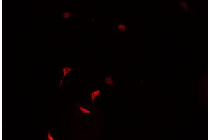 ABIN6266928 staining HeLa  cells by IF/ICC. (ZNF187 Antikörper  (Internal Region))