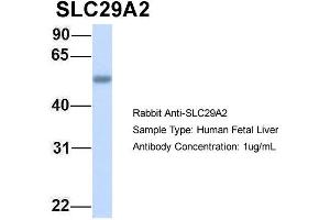Host: Rabbit Target Name: SLC29A2 Sample Type: Human Fetal Liver Antibody Dilution: 1. (SLC29A2 Antikörper  (C-Term))