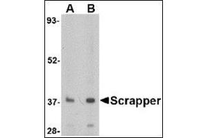 Western blot analysis of SCRAPPER in A20 cell lysate with this product at (A) 0. (FBXL20 Antikörper  (N-Term))