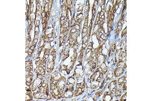 Immunohistochemistry of paraffin-embedded mouse stomach using J Rabbit pAb (ABIN7268040) at dilution of 1:100 (40x lens). (JAK2 Antikörper)