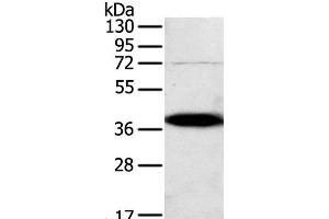 Western Blot analysis of A375 cell using SPARC Polyclonal Antibody at dilution of 1:500 (SPARC Antikörper)
