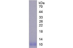 SDS-PAGE analysis of Mouse NOS2 Protein. (NOS2 Protein)