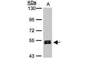 WB Image Sample(30 μg of whole cell lysate) A:HeLa S3, 7. (RPS6KB2 Antikörper  (Center))
