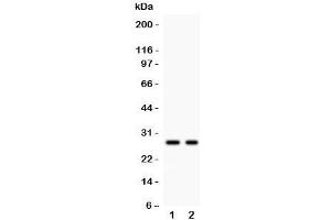 Western blot testing of Kallikrein 4 antibody and Lane 1:  293T;  2: MCF-7 lysate. (Kallikrein 4 Antikörper  (AA 31-254))
