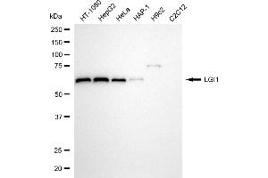Western blotting analysis using LGI1 antibody (ABIN7799257).