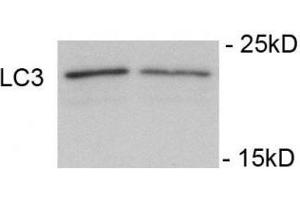 Immunoblots of SH-SY5Y cells treated with rapamycin for 1 h was probed with phospho-LC3C antibody. (LC3C Antikörper  (pSer12))