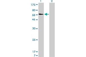 Western Blotting (WB) image for anti-Sorting Nexin 1 (SNX1) (AA 166-276) antibody (ABIN598935) (Sorting Nexin 1 Antikörper  (AA 166-276))