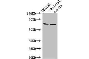 Western Blot Positive WB detected in: HEK293 whole cell lysate, Mouse skeletal muscle tissue All lanes: EFCAB7 antibody at 2. (EFCAB7 Antikörper  (AA 1-158))