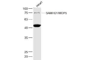 Mouse Heart lysates probed with SAMHD1'MOP5 Polyclonal Antibody, Unconjugated  at 1:500 dilution and 4˚C overnight incubation. (SAMHD1 Antikörper  (AA 256-370))
