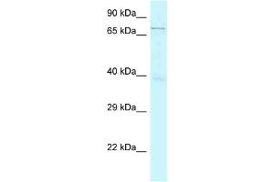 WB Suggested Anti-GSG2 Antibody Titration: 1. (GSG2 Antikörper  (N-Term))