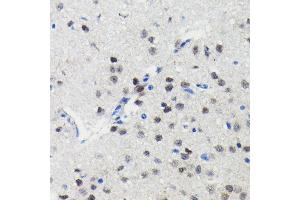 Immunohistochemistry of paraffin-embedded mouse brain using PIM1 antibody (ABIN7269375) at dilution of 1:100 (40x lens). (PIM1 Antikörper)