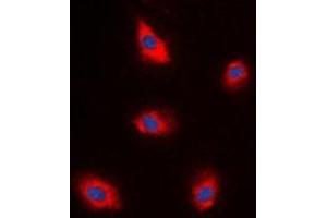 Immunofluorescent analysis of EPS8L1 staining in A549 cells.