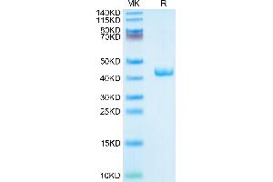 Human CXCL4 on Tris-Bis PAGE under reduced condition. (PF4 Protein (AA 32-101) (Fc Tag))