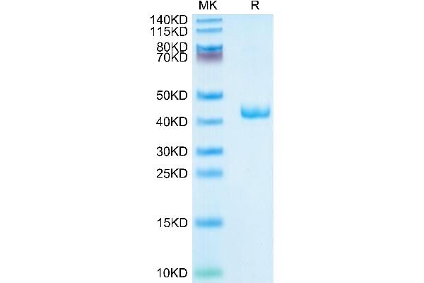 PF4 Protein (AA 32-101) (Fc Tag)