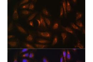 Immunofluorescence analysis of U-2 OS cells using NRBF2 Polyclonal Antibody at dilution of 1:100. (NRBF2 Antikörper)