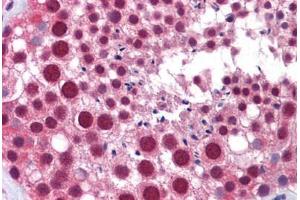 Human Testis: Formalin-Fixed, Paraffin-Embedded (FFPE) (MED17 Antikörper  (AA 551-652))