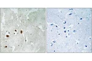 Immunohistochemistry analysis of paraffin-embedded human brain, using Tip60 (Phospho-Ser90) Antibody.