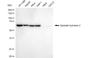 anti-Epoxide Hydrolase 2, Cytoplasmic (EPHX2) antibody