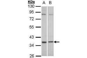 WB Image Sample (30 ug of whole cell lysate) A: HeLa B: Molt-4 , 10% SDS PAGE antibody diluted at 1:1000 (GPR77 Antikörper  (C-Term))