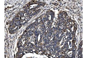 IHC analysis of TJP2/ZO2 using anti-TJP2/ZO2 antibody (ABIN7602800).
