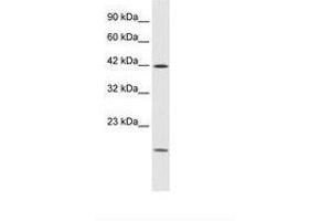 Image no. 1 for anti-Upstream Transcription Factor 1 (USF1) (AA 27-76) antibody (ABIN202215) (USF1 Antikörper  (AA 27-76))