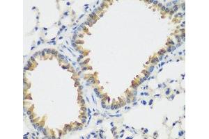 Immunohistochemistry of paraffin-embedded Mouse lung using FLT4 Polyclonal Antibody at dilution of 1:200 (40x lens). (FLT4 Antikörper)