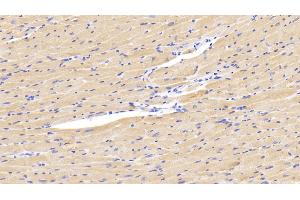 Detection of LOXL1 in Mouse Cardiac Muscle Tissue using Polyclonal Antibody to Lysyl Oxidase Like Protein 1 (LOXL1) (LOXL1 Antikörper  (AA 392-598))