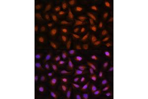 Immunofluorescence analysis of U2OS cells using CTBP2 Rabbit pAb (ABIN1679396, ABIN3015896, ABIN3015897 and ABIN6219473) at dilution of 1:100. (CTBP2 Antikörper  (C-Term))