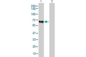 Western Blot analysis of FBLIM1 expression in transfected 293T cell line by FBLIM1 monoclonal antibody (M10), clone 5E11.