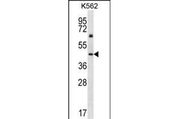 KRT12 抗体  (C-Term)