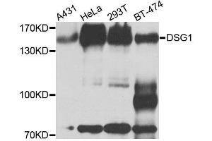 Western blot analysis of extracts of various cell lines, using DSG1 antibody. (Desmoglein 1 Antikörper  (AA 800-1049))